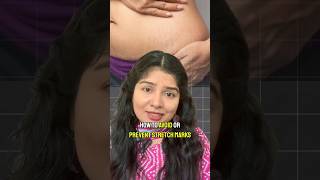 Tips To Prevent Stretch Marks✨ pregnancyjourney pregnancy homeremedies [upl. by Evered]