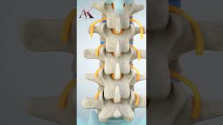 Understanding Intervertebral Discs amp Disc Herniation by Dr Abhijit Kulkarni  Brain amp Spine Surgeon [upl. by Kermit27]