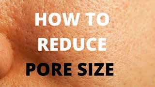 How to reduce pore size [upl. by Yhtak]