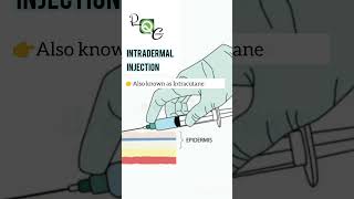 INTRADERMAL INJECTION pharmacy nursing neet science biology [upl. by Travus]