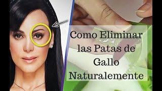 Como Eliminar las Patas de Gallo Naturalmente [upl. by Guimond]