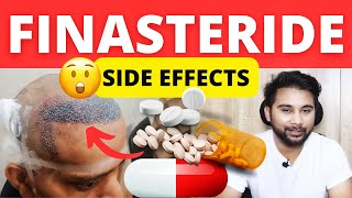 Side Effects Of Finasteride Before amp After Hair Transplant  Hair Transplant Results QnA [upl. by Ennaerb]