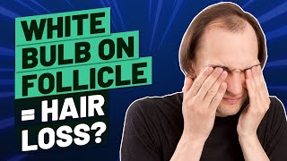 White Bulb on Hair Follicle What Does It Mean [upl. by Files]