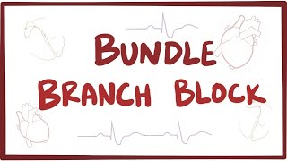 Bundle branch block  causes symptoms diagnosis treatment pathology [upl. by Prud]