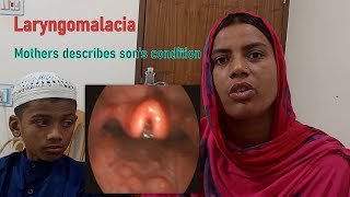 Laryngomalacia Laryngoscopy amp Clinical Feature। Natural History। Mother Describes Sons Condition [upl. by Amerak]