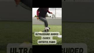 ultrasound guided interventions cases Osteitis Pubis sports sportsmedicine sportsdoctor fyp [upl. by Navonoj]