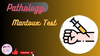 Mantoux Test [upl. by Bill48]