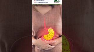 Homeopathic Medicines for Acid Reflux shorts acidity homeopathyasitis [upl. by Solomon343]