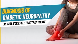 Understanding Diabetic Neuropathy  Diagnosis and Treatment Options with comprehensive plan [upl. by Quartus587]