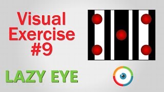 Lazy Eye Exercise 09 [upl. by Nevart485]