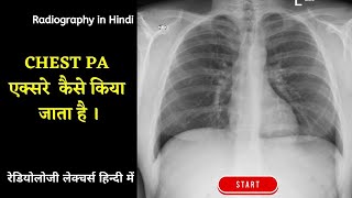 Chest Xray 2  Chest PA View Explained in Hindi radiographyinhindi xrayclasses xraytechnician [upl. by Marjy]