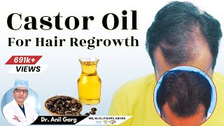 Is Castor Oil Good For Hair Growth  बाल Regrowth के लिए Castor Oil का उपयोग करे  Dr Anil Garg [upl. by Kale611]