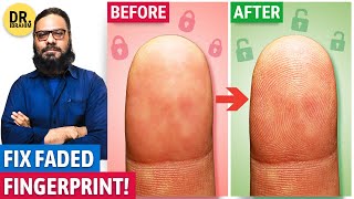 Recover Your Fingerprint Improve Fingerprint Quality  UrduHindi  Dr Ibrahim [upl. by Mikes]