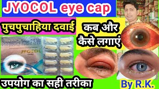 Jyocol eye caps ke fayde  chloramphenicol eye ointment uses in hindi  पुचपुचाहिया दवाई  jyocol [upl. by Crosby]