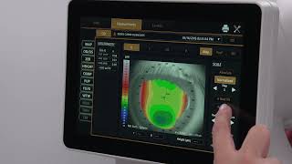 Topcon CA800 Reviewing Corneal Topography Height Maps [upl. by Anceline]