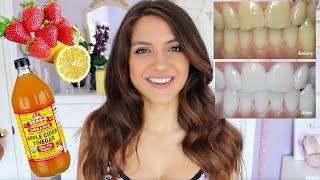 How to WHITEN YOUR TEETH  DIY Teeth Whitening FAST  CHEAP [upl. by Aleit]