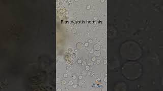 Blastocystis hominis in Stool [upl. by Sirois]