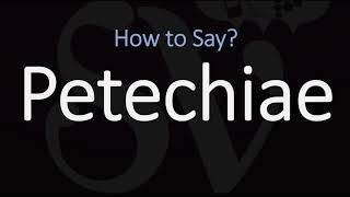 How to Pronounce Petechiae CORRECTLY Meaning amp Pronunciation [upl. by Nahtanoj]