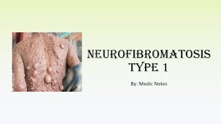 Neurofibromatosis Type 1  definition signs diagnostic criteria management complication [upl. by Anaj]