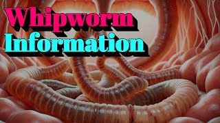 Whipworm Information 🔬Tier4 Infectious Disease [upl. by Prisca]