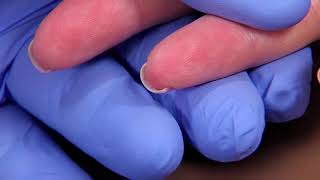 Perform a Capillary Puncture Obtain a Blood Sample by Capillary Puncture [upl. by Moynahan]