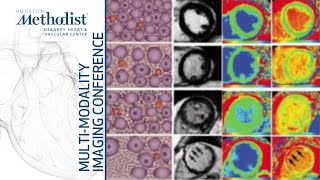 Mitral and Aortic Stenosis Evaluation by Echo amp CMR Chebrolu MD and Nabi MD November 9 2021 [upl. by Elly]