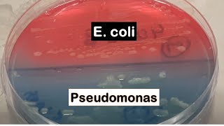 Pseudomonas aeruginosa and Escherichia coli colonies on CLED agar  Uropathogens [upl. by Calvert]