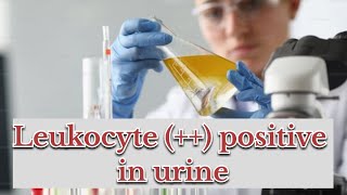 leukocytes positive in urine  symptoms causes  treatment [upl. by Jr4]