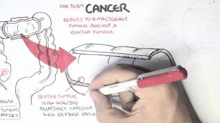 Cancer  Introduction I [upl. by Adnohsak]