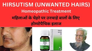 Unwanted Hairs Hirsutismअनचाहे बाल Homeopathic treatment  Natural Healing [upl. by Otti553]