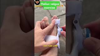 Hallux valgus exercise  Hallux valgus medical solution sorts amry sscgd ssccpo [upl. by Analla]