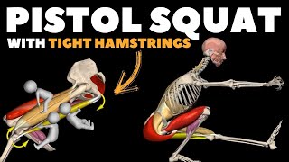 Pistol Squat with Tight Hamstrings [upl. by Arahsal]