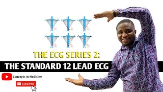 ECG Series 2  The Standard 12Lead ECG Easy Systematic Approach [upl. by Avlem]