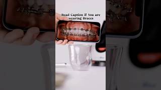 Tips for Bracesbracessmilemakeover shorts teeth [upl. by Moise544]