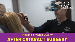 Recovery amp Vision Expectations After Cataract Surgery [upl. by Htomit658]