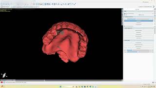 3D Printed Denture Scan Alignment in Blue Sky Bio [upl. by Nigel]