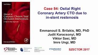 Case 84 Manual of CTO Interventions  Ostial right coronary artery CTO due to ISR [upl. by Isied]