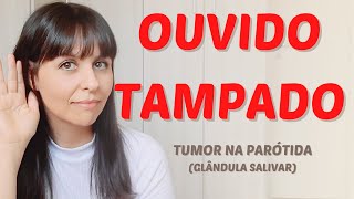 Ouvido tampado  tumor na parótida [upl. by Torrey]