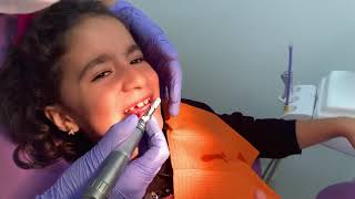 Limpieza Dental Infantil [upl. by Mesics]