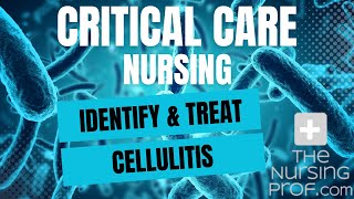 Critical Care Nursing Identify and Treat Cellulitis [upl. by Dnanidref]