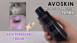 BEST EXFOLIATING TONER  AVOSKIN MIRACULOUS REFINING TONER [upl. by Krusche218]