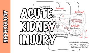 Acute Kidney Injury AKI  prerenal intrarenal and postrenal causes and pathophysiology [upl. by Coraline]