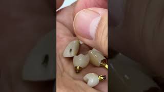 Final implants with ceramics Jewelry [upl. by Gnirps]