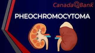 Pheochromocytoma [upl. by Laet]