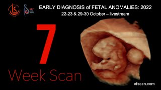 7 Week Scan in Fetal Medicine Early Fetal Scan Conference 2022 [upl. by Atinuj586]