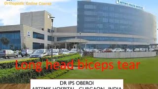 Long head biceps tear DrIPS OBEROI irreparable RC tear Prof Amr Rashwan [upl. by Natehc97]