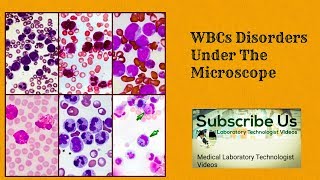 WBC Disorders Under The Microscope [upl. by Akire]