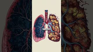 Mullein lung detox [upl. by Akenat]