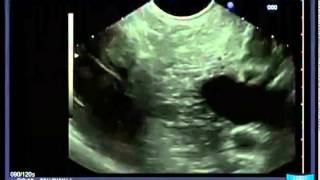 Longitudinal EUS Anatomical Guiding Structures in the Upper Abdomen Cranial  Right [upl. by Agathy]