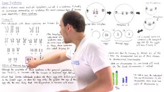 Down Syndrome Trisomy 21 and Translocation [upl. by Chally]